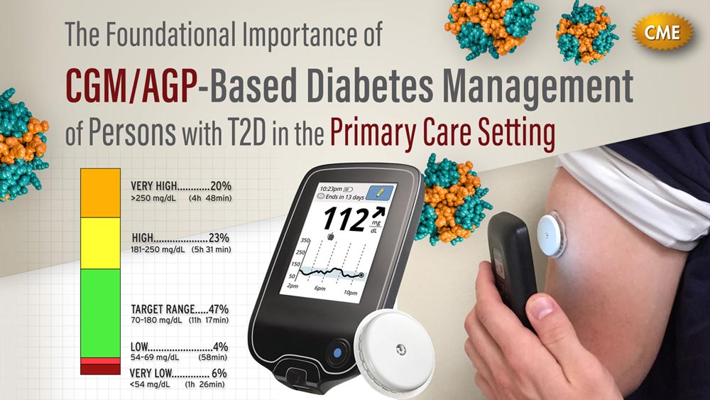 CGM/AGP-Based Diabetes Management of Persons with T2D in the Primary Care Setting